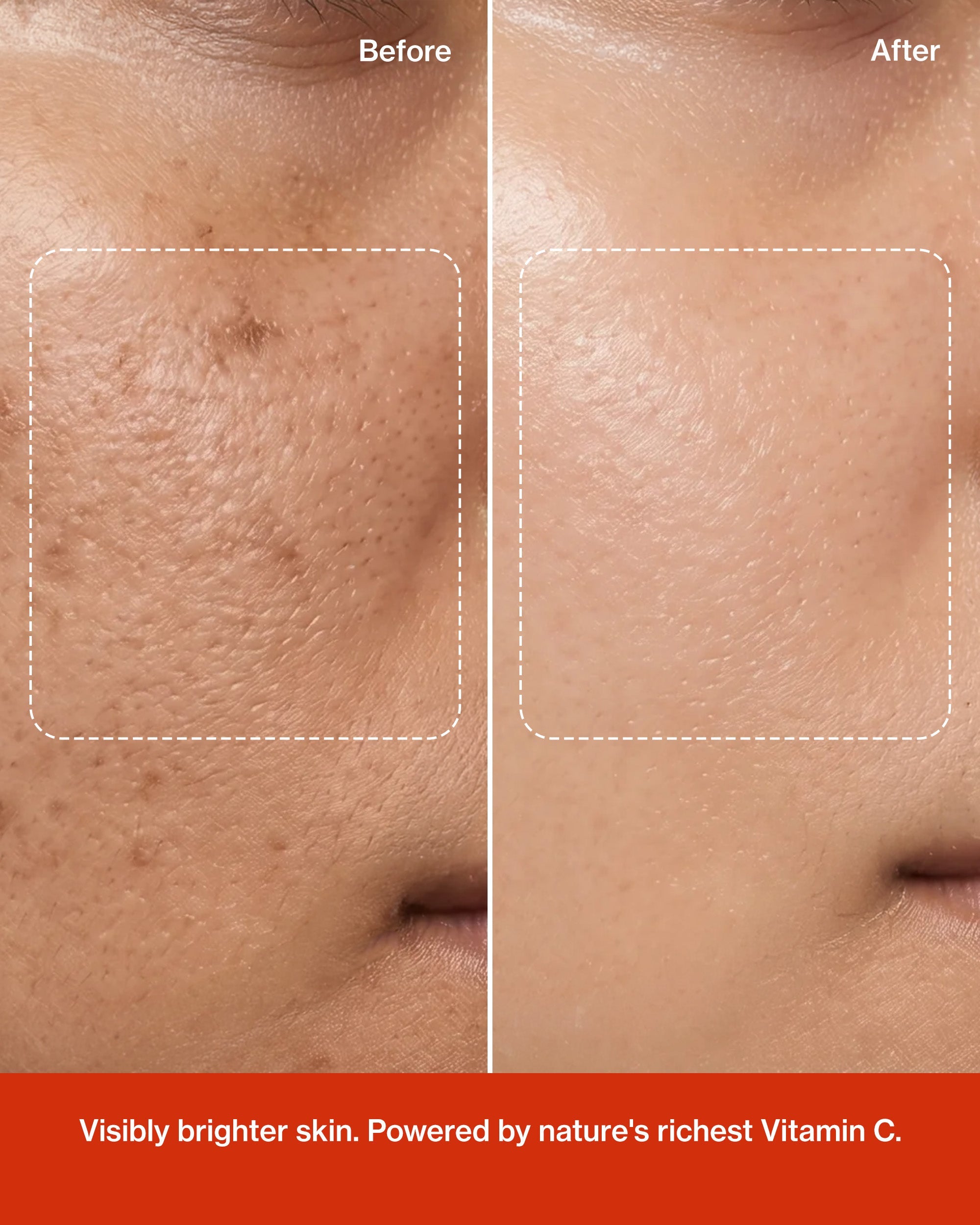 Glow Vitamin C Skin  Brightening Serum