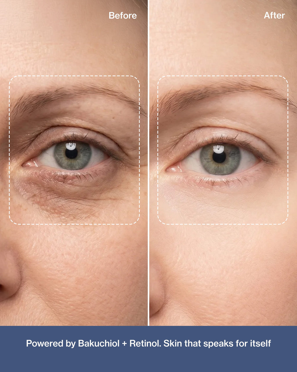 Supercharge Bakuchiol Retinol Serum