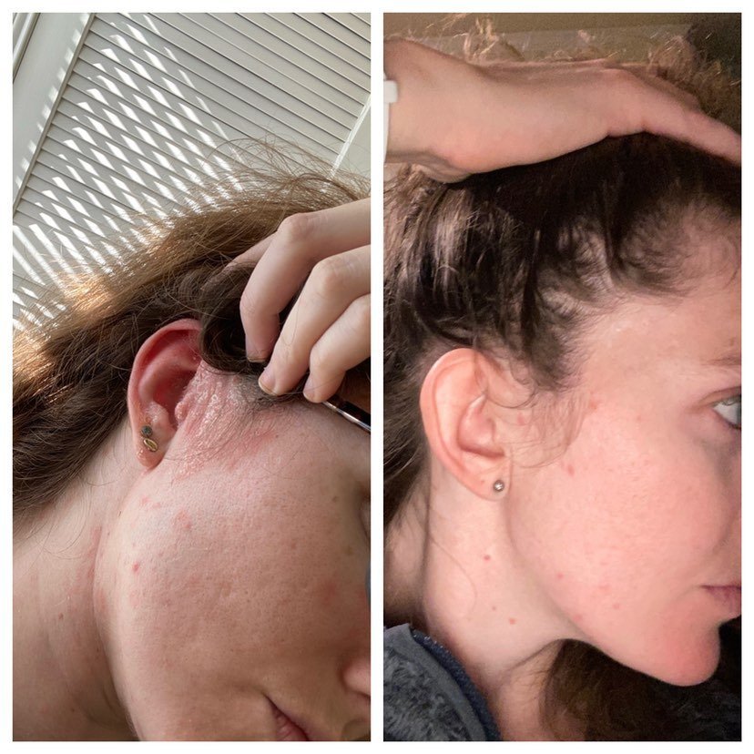 GoodBiome®️ Prebiotic Facial Solution: Liquid AHA + BHA Serum